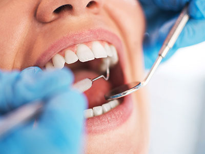 Right Cosmetic Dentist for You - Article Image